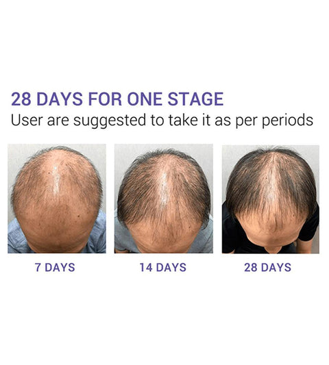 Hair Care Hair Growth Essential Oils Essence Original Authentic 100% Hair Loss Liquid Health Care Beauty Dense Hair Growth Serum